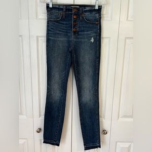 Madewell 10” High Rise Skinny